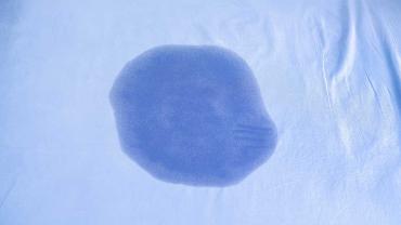 Urinfleck auf blauem Bettlaken als Symbol für nächtliches Einnässen bei Kindern