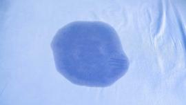 Urinfleck auf blauem Bettlaken als Symbol für nächtliches Einnässen bei Kindern